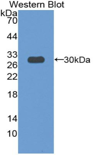 Polyclonal Antibody to Paxillin (PXN)