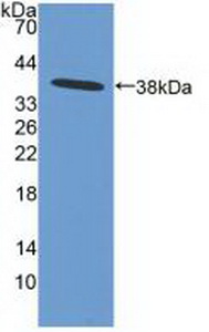Polyclonal Antibody to Inhibitory Subunit Of NF Kappa B Beta (IkBb)