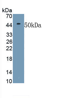 Polyclonal Antibody to Matrix Metalloproteinase 19 (MMP19)