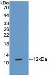 Polyclonal Antibody to Major Histocompatibility Complex Class I G (MHCG)