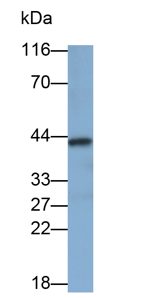 Polyclonal Antibody to Lectin Like Oxidized Low Density Lipoprotein Receptor 1 (LOX1)