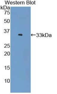 Polyclonal Antibody to Lectin Like Oxidized Low Density Lipoprotein Receptor 1 (LOX1)