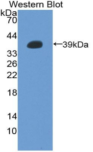 Polyclonal Antibody to Metallothionein 2 (MT2)