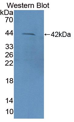 Polyclonal Antibody to Cluster Of Differentiation 3d (CD3d)