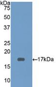 Polyclonal Antibody to Cluster Of Differentiation 3d (CD3d)