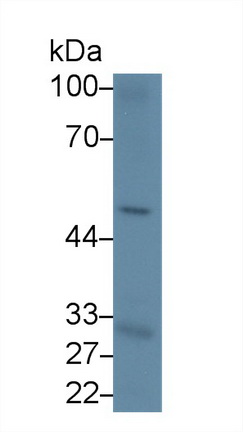 Polyclonal Antibody to Cluster Of Differentiation 19 (CD19)