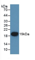 Polyclonal Antibody to Coagulation Factor VII (F7)