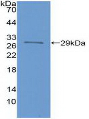 Polyclonal Antibody to Forkhead Box P3 (FOXP3)