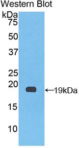 Polyclonal Antibody to Coagulation Factor VIII (F8)