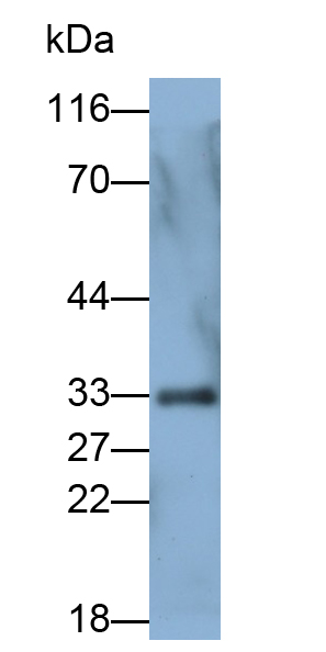 Polyclonal Antibody to Coagulation Factor VIII (F8)