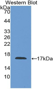 Polyclonal Antibody to Coagulation Factor VIII (F8)