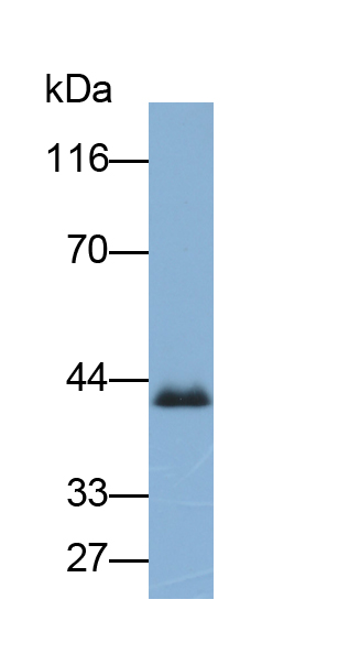 Polyclonal Antibody to Coagulation Factor VIII (F8)