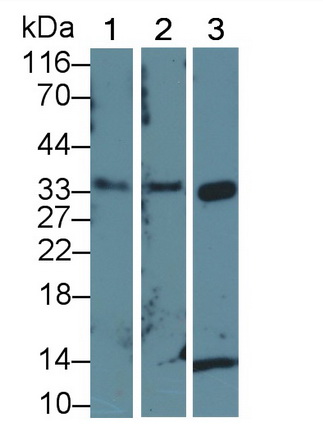 Polyclonal Antibody to Cyclin Dependent Kinase 2 (CDK2)