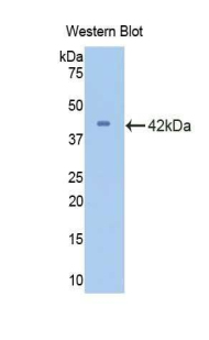 Polyclonal Antibody to Cyclin Dependent Kinase 2 (CDK2)