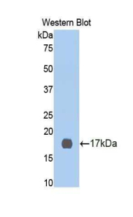 Polyclonal Antibody to Cyclin Dependent Kinase 2 (CDK2)