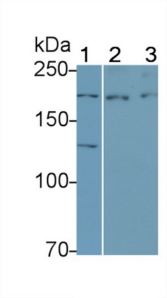 Polyclonal Antibody to Vascular Endothelial Growth Factor Receptor 3 (VEGFR3)