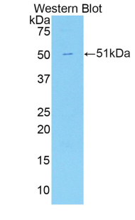 Polyclonal Antibody to Cadherin, Heart (CDHH)