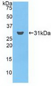 Polyclonal Antibody to Ficolin 3 (FCN3)