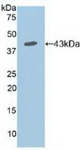 Polyclonal Antibody to Interleukin 7 Receptor (IL7R)