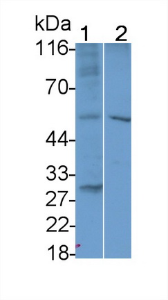 Polyclonal Antibody to Interleukin 7 Receptor (IL7R)