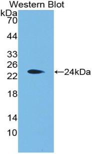 Polyclonal Antibody to Aggrecan (AGC)