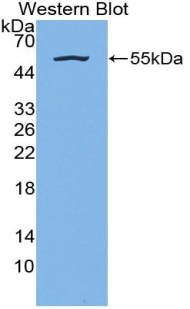 Polyclonal Antibody to Kallikrein 7 (KLK7)