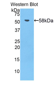 Polyclonal Antibody to Bruton'S Tyrosine Kinase (Btk)