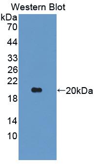 Polyclonal Antibody to Angiopoietin Like Protein 2 (ANGPTL2)