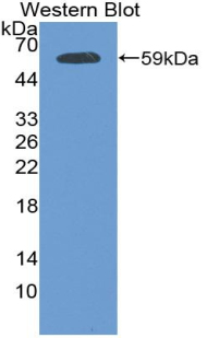 Polyclonal Antibody to Plakophilin 1 (PKP1)