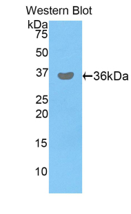 Polyclonal Antibody to Pyruvate Dehydrogenase Beta (PDHb)