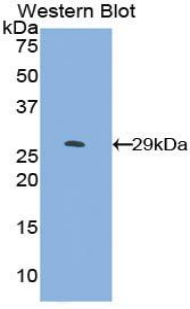 Polyclonal Antibody to Mothers Against Decapentaplegic Homolog 4 (Smad4)