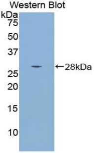 Polyclonal Antibody to Mothers Against Decapentaplegic Homolog 4 (Smad4)