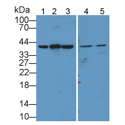 Polyclonal Antibody to Glyceraldehyde-3-Phosphate Dehydrogenase (GAPDH)