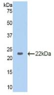 Polyclonal Antibody to Glyceraldehyde-3-Phosphate Dehydrogenase (GAPDH)