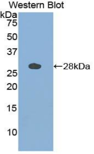 Polyclonal Antibody to Cathepsin S (CTSS)