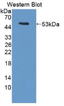 Polyclonal Antibody to Leucine Rich Alpha-2-Glycoprotein 1 (LRG1)