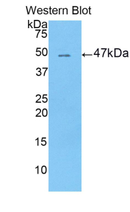 Polyclonal Antibody to Leucine Rich Alpha-2-Glycoprotein 1 (LRG1)