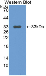 Polyclonal Antibody to Leucine Rich Alpha-2-Glycoprotein 1 (LRG1)