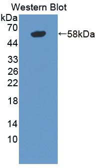 Polyclonal Antibody to Tenascin X (TNX)