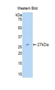 Polyclonal Antibody to Tissue Factor Pathway Inhibitor 2 (TFPI2)