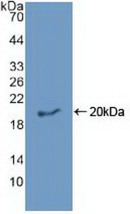 Polyclonal Antibody to Epiregulin (EREG)