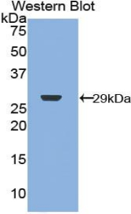 Polyclonal Antibody to Neurofibromin 2 (NF2)