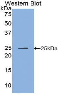 Polyclonal Antibody to Inhibitor Of Nuclear Factor Kappa B Kinase Interacting Protein (IKBIP)