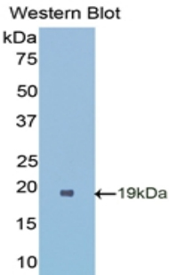 Polyclonal Antibody to Superoxide Dismutase 1 (SOD1)