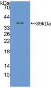 Polyclonal Antibody to Arachidonate-12-Lipoxygenase (ALOX12)