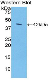 Polyclonal Antibody to Syndecan 1 (SDC1)