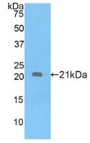 Polyclonal Antibody to Apolipoprotein D (APOD)