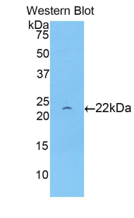 Polyclonal Antibody to Apolipoprotein D (APOD)