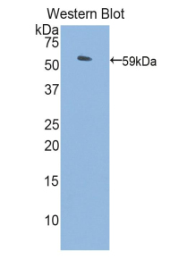 Polyclonal Antibody to Protein S (PROS)