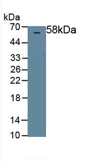 Polyclonal Antibody to Pigment Epithelium Derived Factor (PEDF)